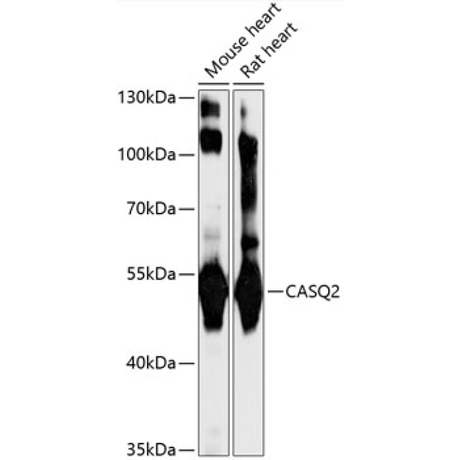 CASQ2 Rabbit Polyclonal Antibody