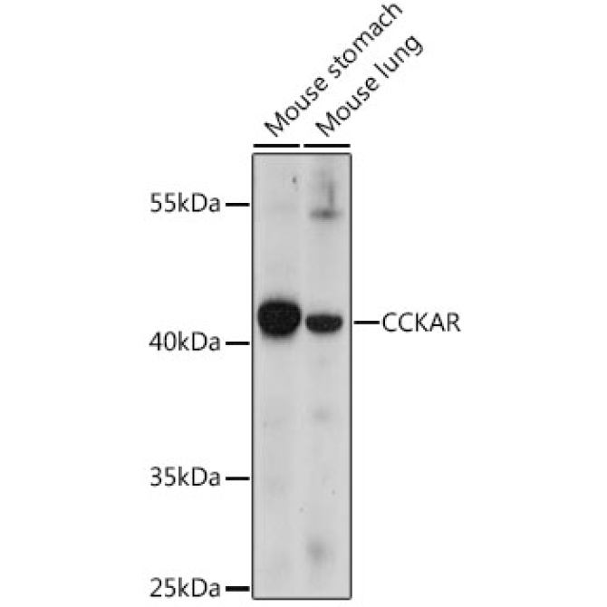CCKAR Rabbit Polyclonal Antibody