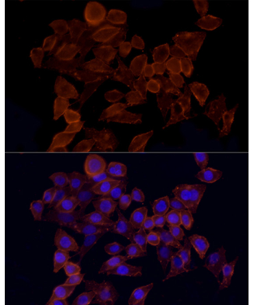 CD44 Rabbit Polyclonal Antibody