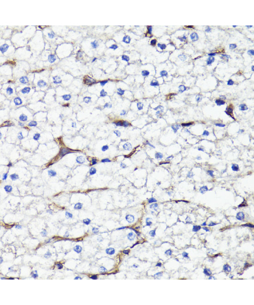 CD44 Rabbit Polyclonal Antibody