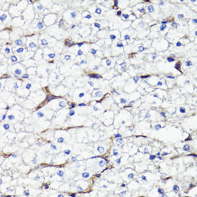CD44 Rabbit Polyclonal Antibody