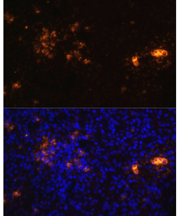 CD70 Rabbit Polyclonal Antibody