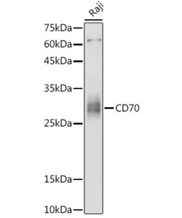 CD70 Rabbit Polyclonal Antibody