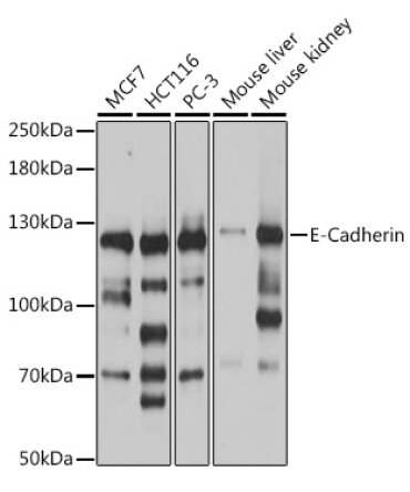 E-Cadherin Rabbit Polyclonal Antibody
