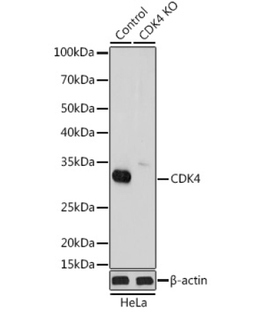 CDK4 Rabbit Polyclonal Antibody [KO Validated]