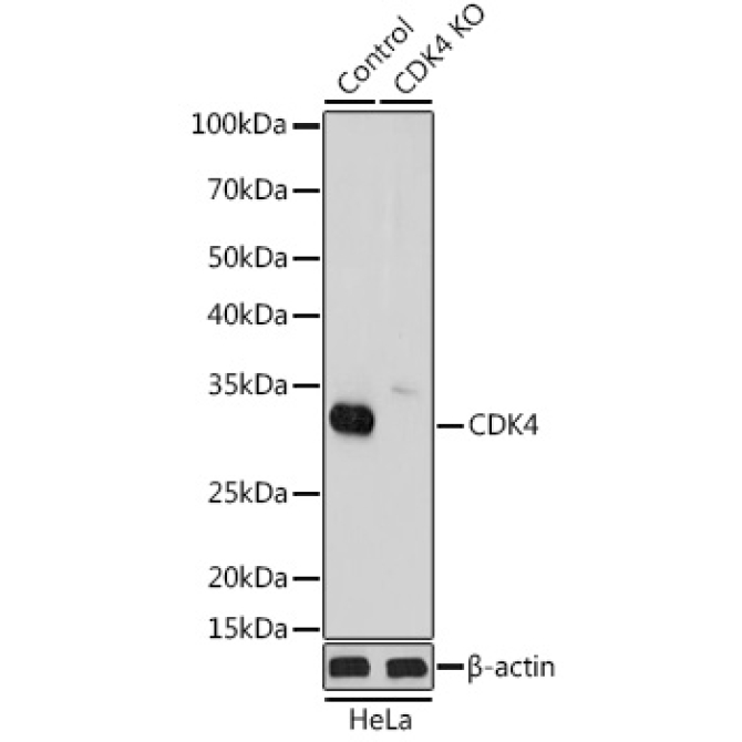 CDK4 Rabbit Polyclonal Antibody [KO Validated]