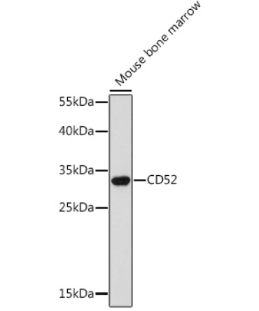 CD52 Rabbit Polyclonal Antibody