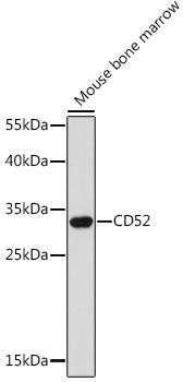 CD52 Rabbit Polyclonal Antibody