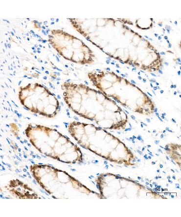 CDX2 Rabbit Polyclonal Antibody