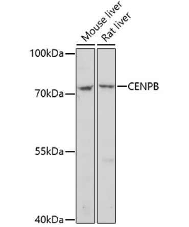CENPB Rabbit Polyclonal Antibody