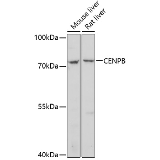 CENPB Rabbit Polyclonal Antibody
