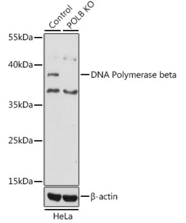 DNA Polymerase beta Rabbit Polyclonal Antibody [KO Validated]
