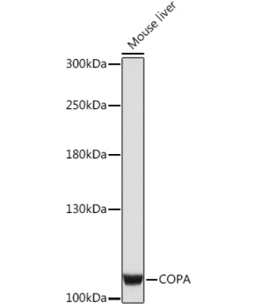 COPA Rabbit Polyclonal Antibody