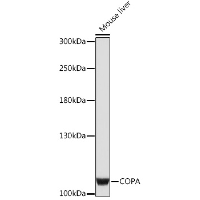 COPA Rabbit Polyclonal Antibody