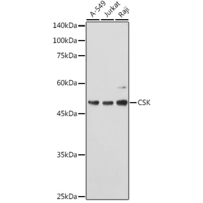 CSK Rabbit Polyclonal Antibody