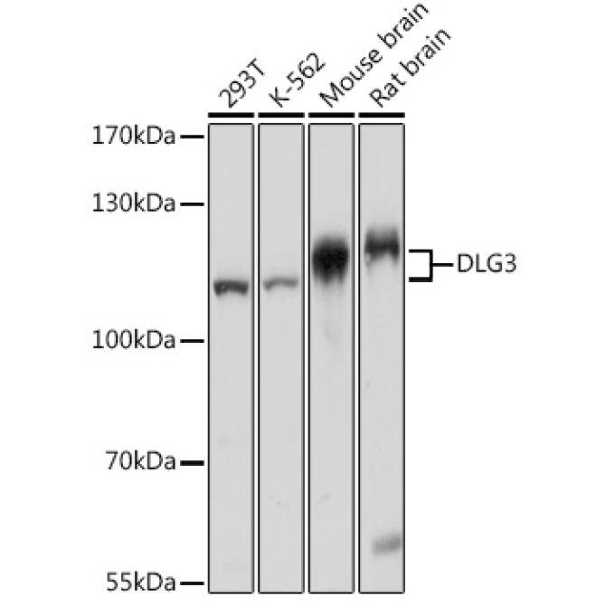 DLG3 Rabbit Polyclonal Antibody