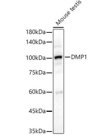 DMP1 Rabbit Polyclonal Antibody