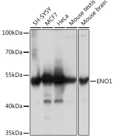 ENO1 Rabbit Polyclonal Antibody