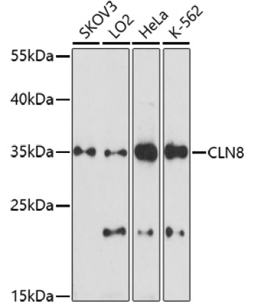 CLN8 Rabbit Polyclonal Antibody