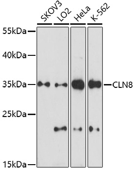 CLN8 Rabbit Polyclonal Antibody
