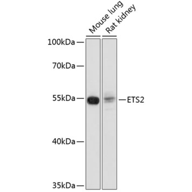 ETS2 Rabbit Polyclonal Antibody