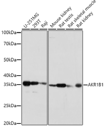 AKR1B1 Rabbit Polyclonal Antibody