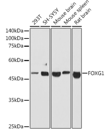 FOXG1 Rabbit Polyclonal Antibody