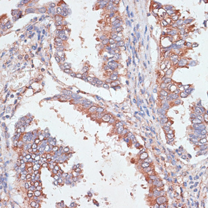 GAB1 Rabbit Polyclonal Antibody