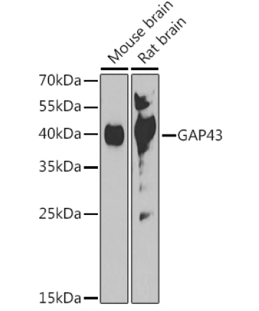 GAP43 Rabbit Polyclonal Antibody