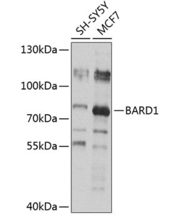 BARD1 Rabbit Polyclonal Antibody