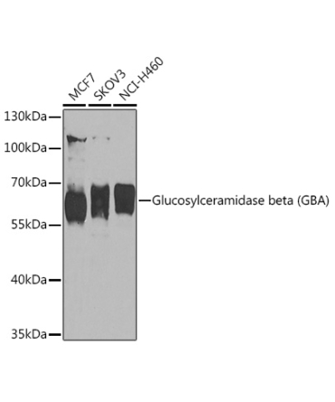 Glucosylceramidase beta (GBA) Rabbit Polyclonal Antibody