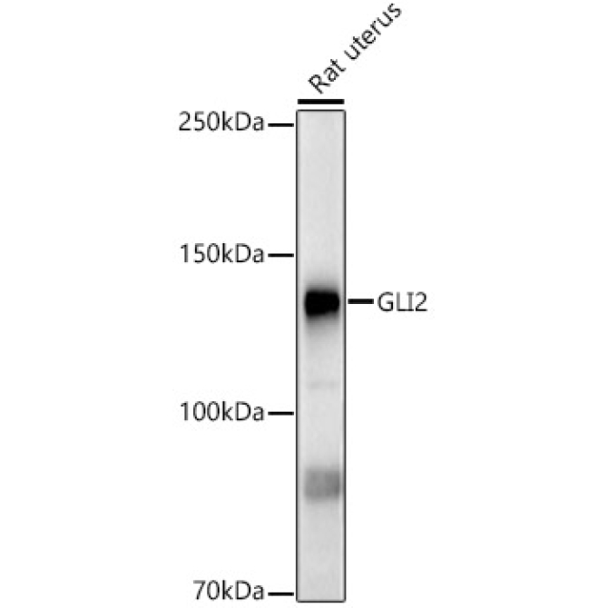 GLI2 Rabbit Polyclonal Antibody