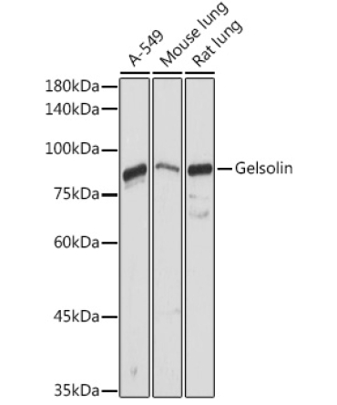 Gelsolin Rabbit Polyclonal Antibody
