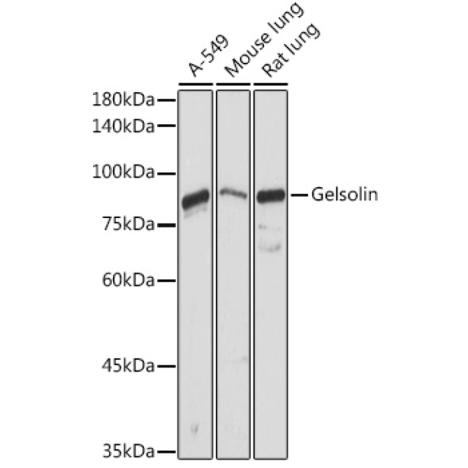 Gelsolin Rabbit Polyclonal Antibody