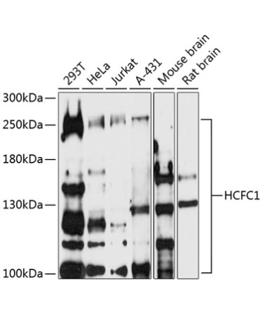 HCFC1 Rabbit Polyclonal Antibody