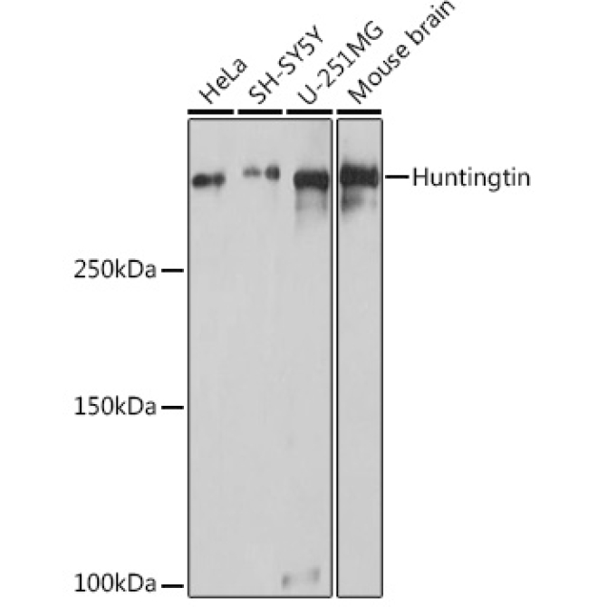 Huntingtin Rabbit Polyclonal Antibody