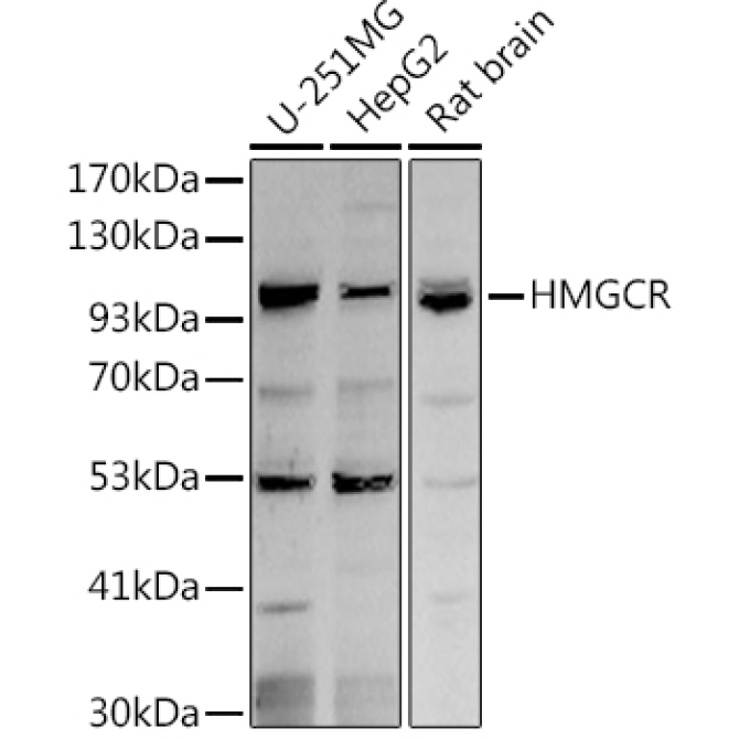 HMGCR Rabbit Polyclonal Antibody