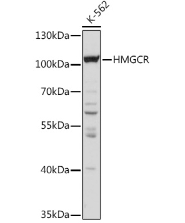 HMGCR Rabbit Polyclonal Antibody