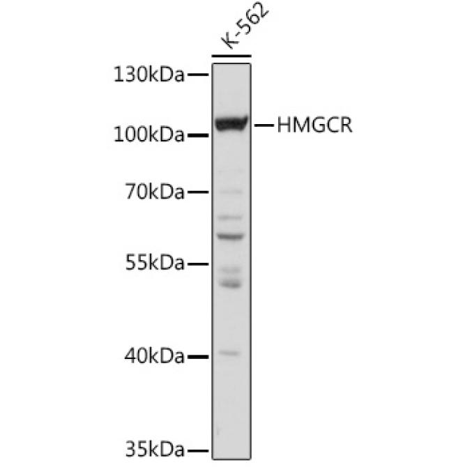 HMGCR Rabbit Polyclonal Antibody