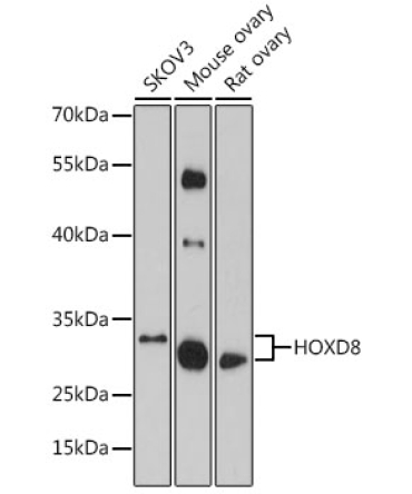HOXD8 Rabbit Polyclonal Antibody