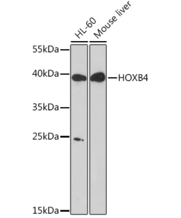 HOXB4 Rabbit Polyclonal Antibody