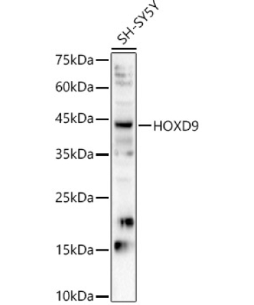 HOXD9 Rabbit Polyclonal Antibody