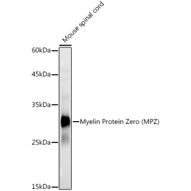 Myelin Protein Zero (MPZ) Rabbit Polyclonal Antibody