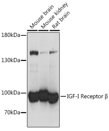 IGF1R Rabbit Polyclonal Antibody