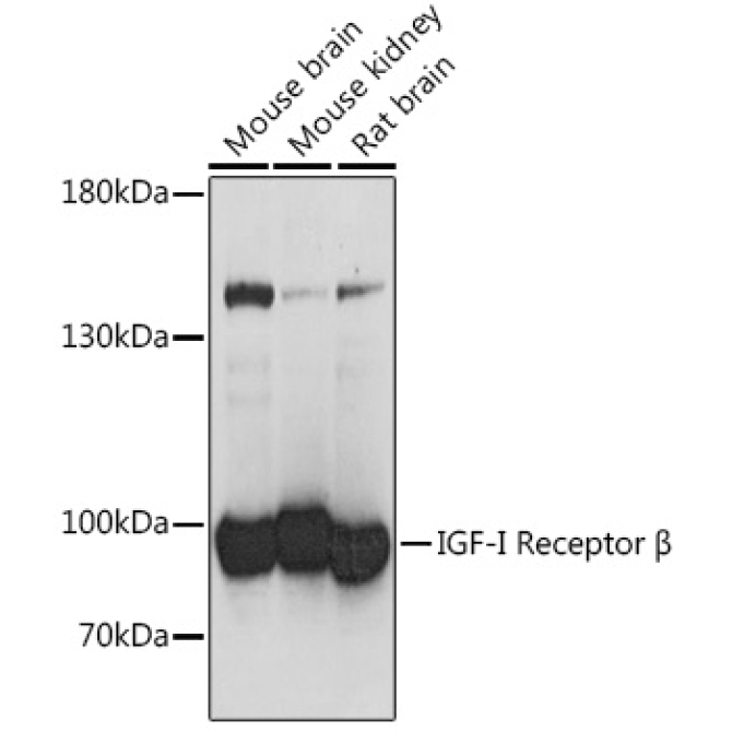 IGF1R Rabbit Polyclonal Antibody