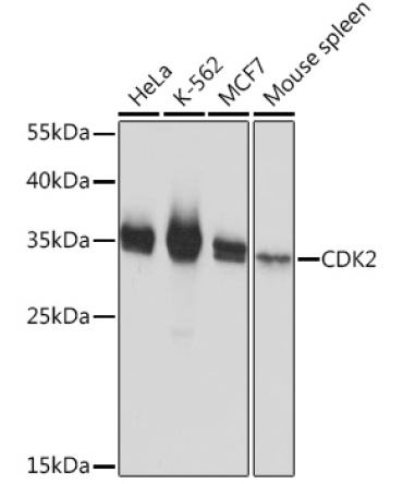 CDK2 Rabbit Polyclonal Antibody [KO Validated]