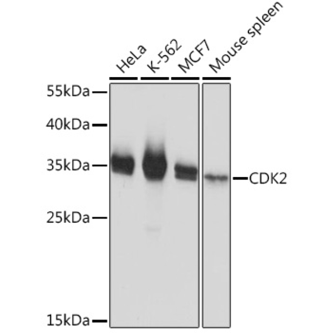 CDK2 Rabbit Polyclonal Antibody [KO Validated]