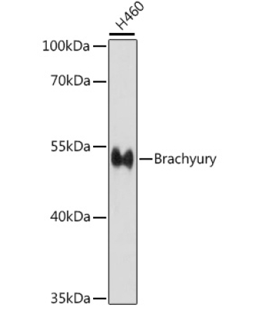 Brachyury Rabbit Polyclonal Antibody