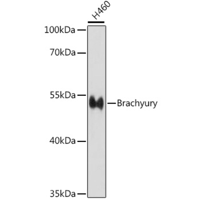 Brachyury Rabbit Polyclonal Antibody