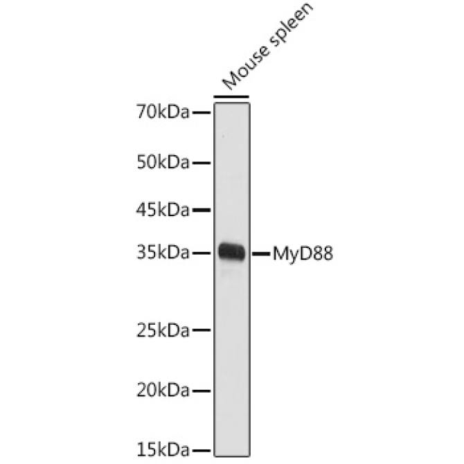 MyD88 Rabbit Polyclonal Antibody